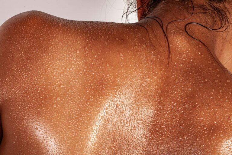 bbl for sun damage