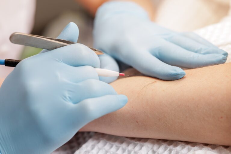 Electrolysis