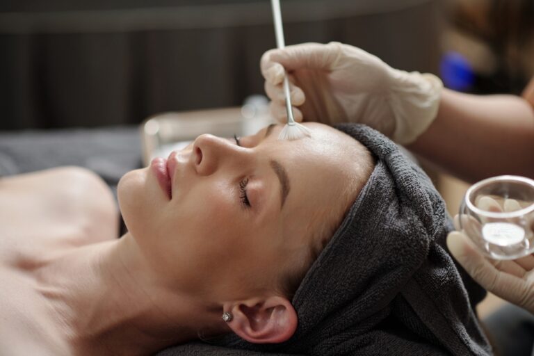 Chemical Peel