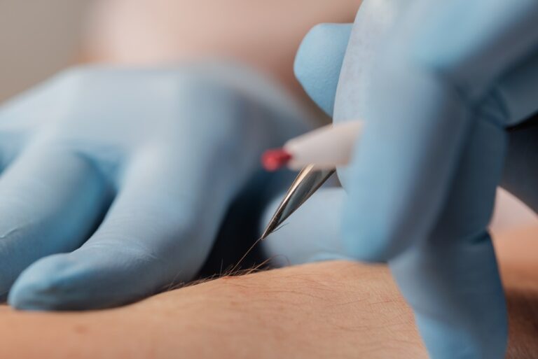 Electrolysis-vs-LHR