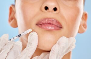 lip fillers