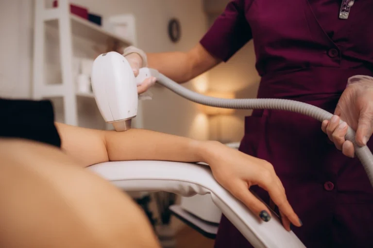 NdYAG Laser Hair Removal