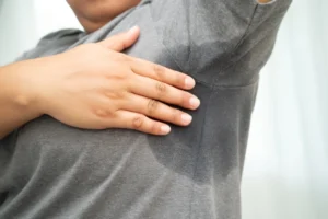 excesive sweating
