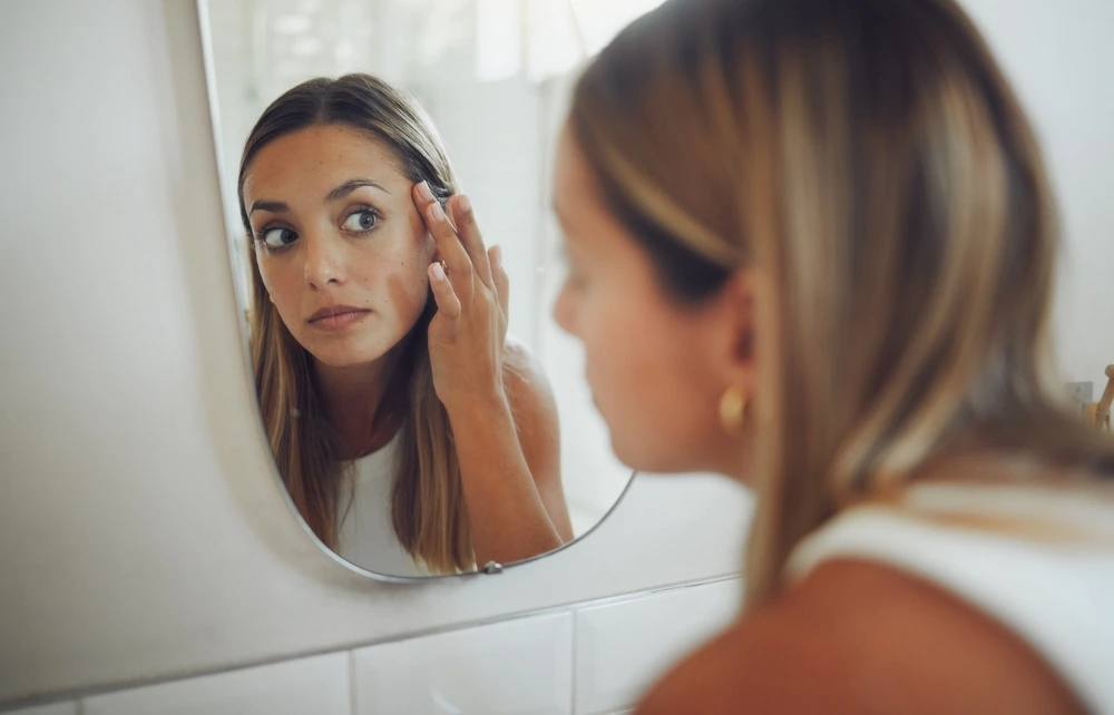 hyperpigmentation