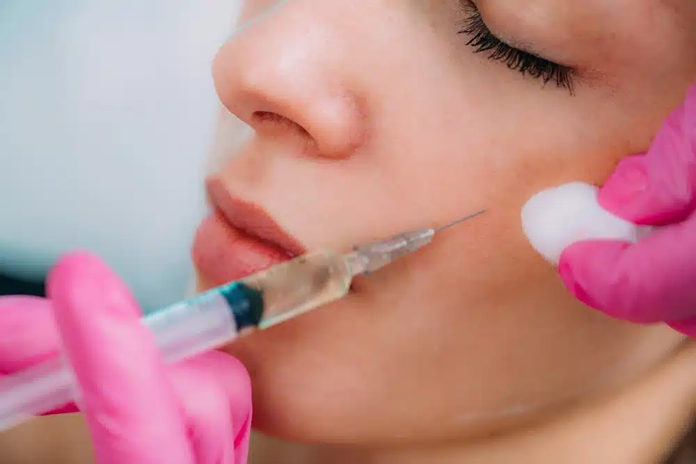 Cheek Filler