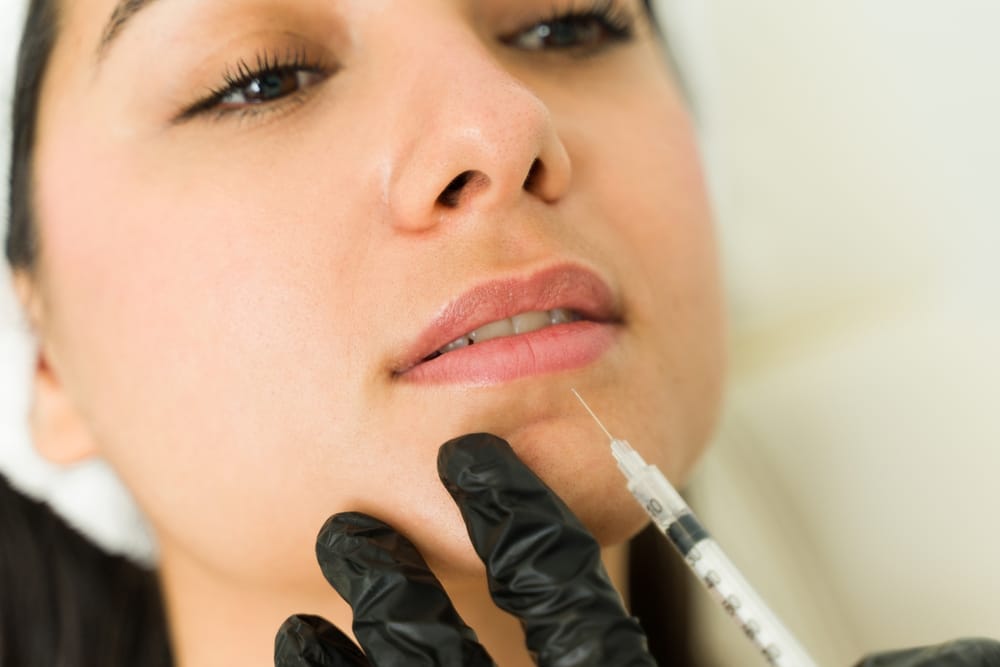 Lip Fillers Louisville