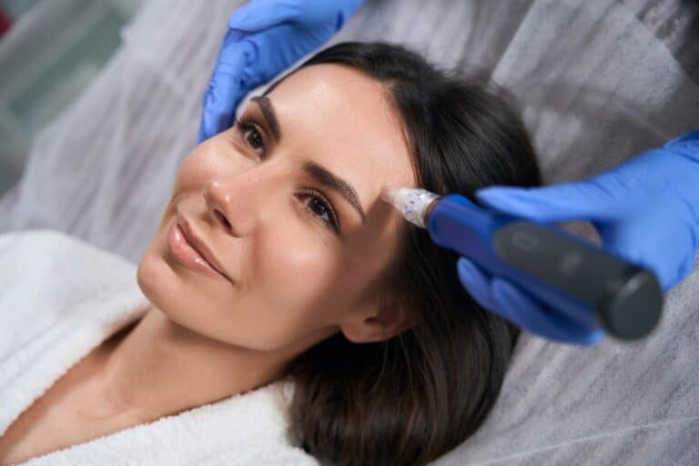 Microneedling-KOP