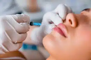 Lip fillers Cincinnati