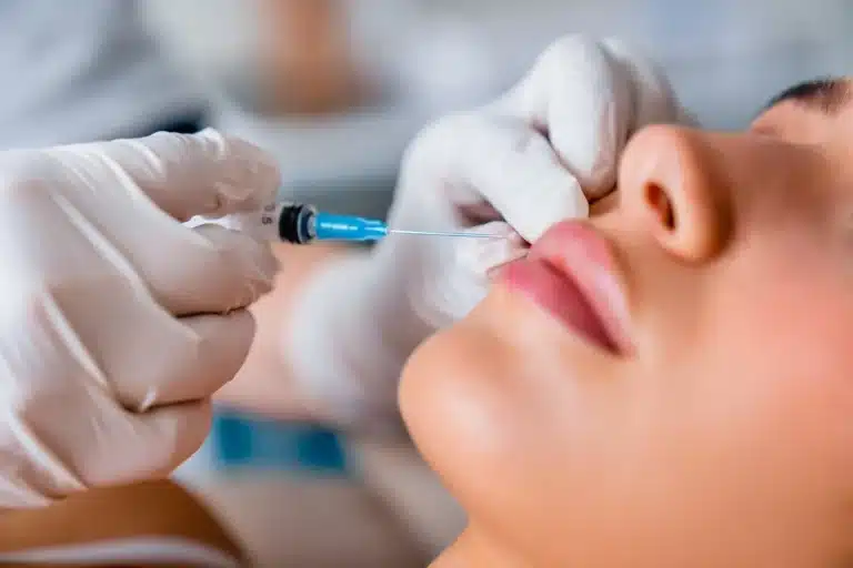 Lip fillers Cincinnati