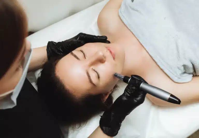 Microneedling Louisville